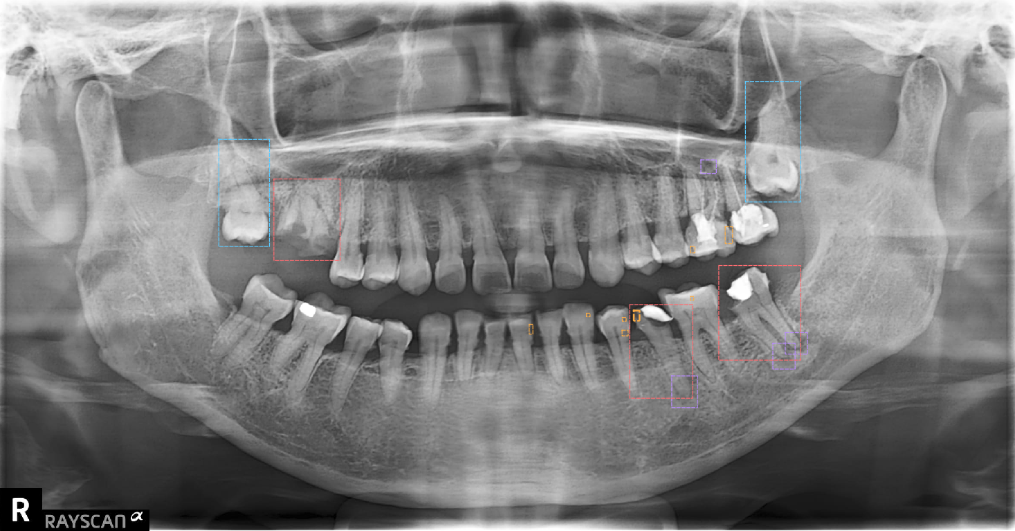 Panoramic image with example boxes